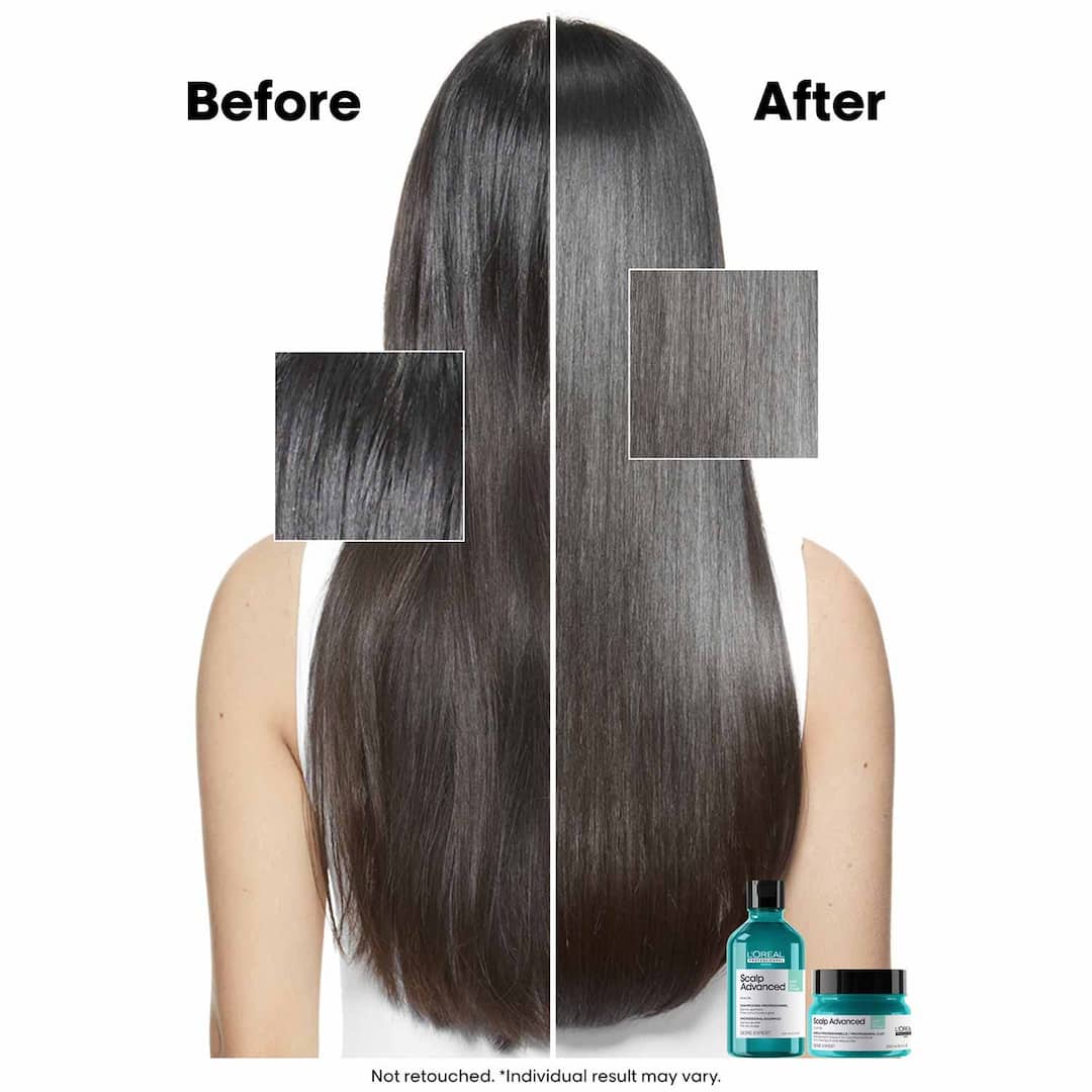 L'Oreal  Professionnel Paris Scalp Advanced Anti-Gras Oiliness Mask, 250ml5