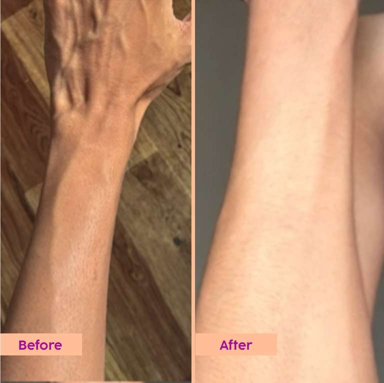 Plix Peaches & Lemon Detan Body Lotion with SPF 30 | Brightens & Moisturizes for Softer Skin, 150ml