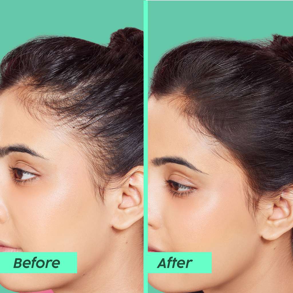 Plix Rosemary Anti-Hair Fall Treatment Advanced Hair Mask for Rough, Dry & Frizzy Hair, 200g